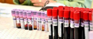 FDA a aprobat prima terapie genică împotriva surdității ereditare