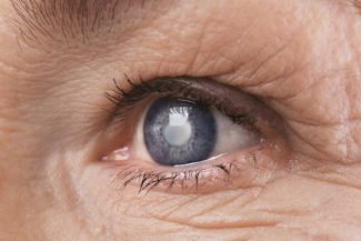 Eurostat: Cea mai frecventă procedură chirurgicală efectuată în spitalele din UE în 2023 a fost operaţia de cataractă / România, cea mai mică rată la 100.000 de locuitori /  Peste un milion de cezariene în UE, cele mai multe în Cipru şi România