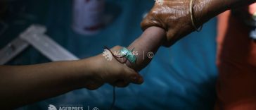 Epidemia de rujeolă se agravează în Bangladesh; 194 de decese înregistrate în total