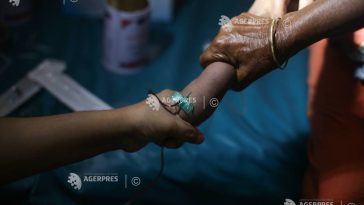 Epidemia de rujeolă se agravează în Bangladesh; 194 de decese înregistrate în total