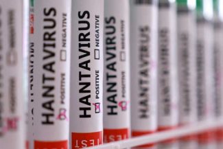 Hantavirus/ Până în prezent, ”nu se poate confirma originea contagiunii” (Ministerul Sănătății din Argentina)