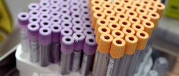 Arad: Bărbatul testat pozitiv la hantavirus a locuit singur, în condiții precare, înainte să ajungă la spital