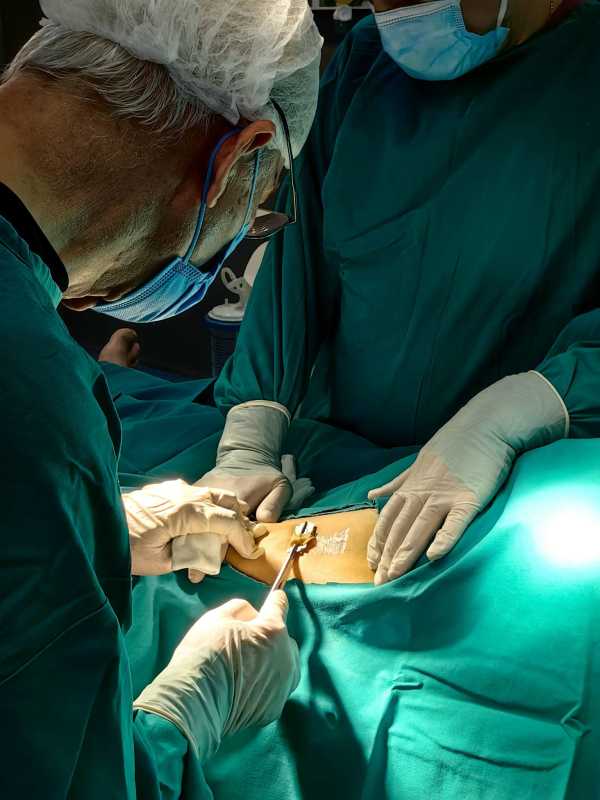 Bacău: Operație complexă realizată în premieră la Spitalul ‘Prof. Dr. Eduard Apetrei’ Buhuși
