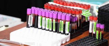 Un simplu test sangvin oferă perspective promițătoare pentru personalizarea terapiei împotriva cancerului pulmonar