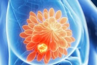 Vârsta influenţează răspândirea cancerului: evoluţie diferită la tineri, adulţi şi vârstnici – studiu