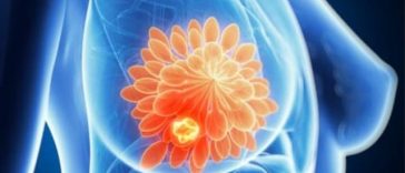 Vârsta influenţează răspândirea cancerului: evoluţie diferită la tineri, adulţi şi vârstnici – studiu