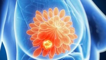 Vârsta influenţează răspândirea cancerului: evoluţie diferită la tineri, adulţi şi vârstnici – studiu