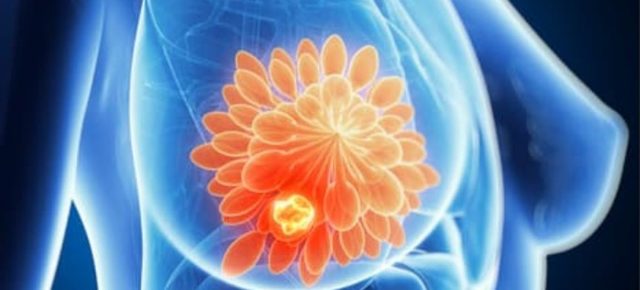 Vârsta influenţează răspândirea cancerului: evoluţie diferită la tineri, adulţi şi vârstnici – studiu