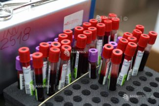 Specialiștii DSP Arad spun că infecția cu hantavirus confirmată era una cronică, nu recentă