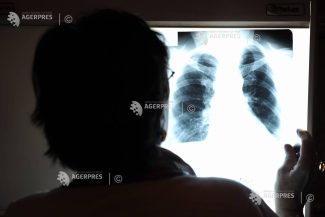 Semnal de alarmă transmis de specialiști și reprezentanți ai asociațiilor de pacienți cu prilejul Zilei Mondiale a Hipertensiunii Pulmonare