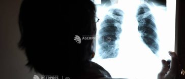 Semnal de alarmă transmis de specialiști și reprezentanți ai asociațiilor de pacienți cu prilejul Zilei Mondiale a Hipertensiunii Pulmonare