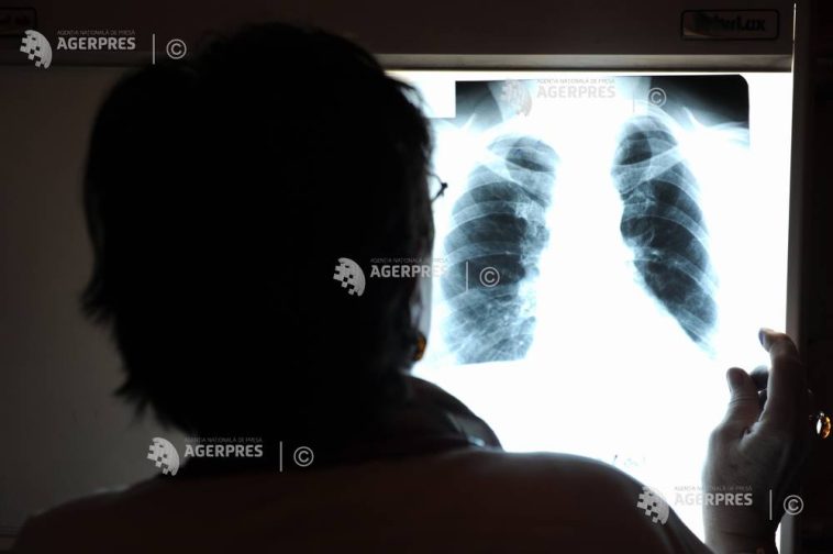 Semnal de alarmă transmis de specialiști și reprezentanți ai asociațiilor de pacienți cu prilejul Zilei Mondiale a Hipertensiunii Pulmonare
