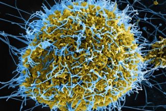 Ebola în RD Congo: 131 de decese estimate şi 513 cazuri suspecte. Directorul OMS se declară „profund îngrijorat de amploarea şi rapiditatea” epidemiei. Surse: testele defectuoase şi funeraliile au permis răspândirea virusului fără a fi detectat