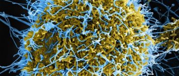 Ebola în RD Congo: 131 de decese estimate şi 513 cazuri suspecte. Directorul OMS se declară „profund îngrijorat de amploarea şi rapiditatea” epidemiei. Surse: testele defectuoase şi funeraliile au permis răspândirea virusului fără a fi detectat