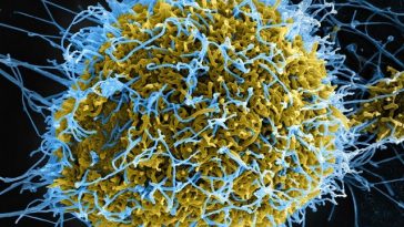 Ebola în RD Congo: 131 de decese estimate şi 513 cazuri suspecte. Directorul OMS se declară „profund îngrijorat de amploarea şi rapiditatea” epidemiei. Surse: testele defectuoase şi funeraliile au permis răspândirea virusului fără a fi detectat