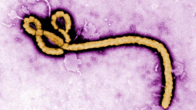 Un caz de Ebola confirmat într-o zonă din Congo controlată de rebeli, departe de epicentrul epidemiei