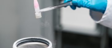 Un organ mai puţin studiat ar putea avea un rol major în durata de viaţă – studiu