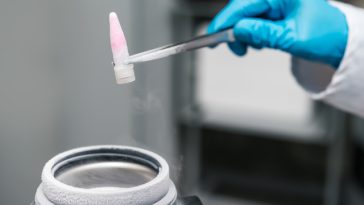 Un organ mai puţin studiat ar putea avea un rol major în durata de viaţă – studiu