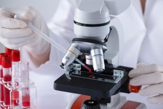 În premieră, cercetătorii au observat cum limfocitele T atacă celulele canceroase în interiorul tumorilor umane, folosind o tehnică avansată de imagistică