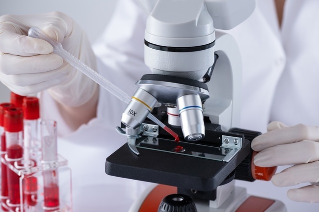 În premieră, cercetătorii au observat cum limfocitele T atacă celulele canceroase în interiorul tumorilor umane, folosind o tehnică avansată de imagistică
