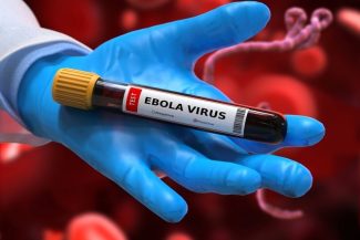 Virusul Ebola poate persista în creier luni sau chiar ani după infecţie. Ce au descoperit oamenii de ştiinţă