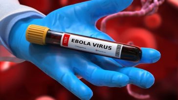 Virusul Ebola poate persista în creier luni sau chiar ani după infecţie. Ce au descoperit oamenii de ştiinţă