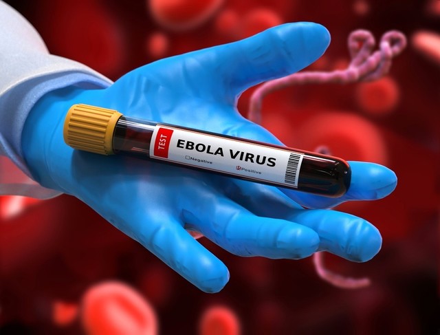 Virusul Ebola poate persista în creier luni sau chiar ani după infecţie. Ce au descoperit oamenii de ştiinţă