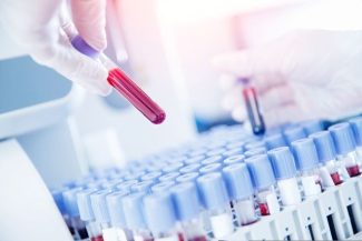 Un medicament promite să fie revoluţionar împotriva cancerului pancreatic: dublează rata de supravieţuire şi îmbunătăţeşte calitatea vieţii
