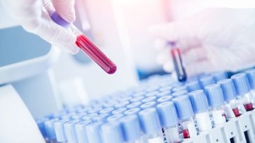 Un medicament promite să fie revoluţionar împotriva cancerului pancreatic: dublează rata de supravieţuire şi îmbunătăţeşte calitatea vieţii