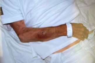 Mărturii cutremurătoare despre pacienţii exploataţi de reţeaua din Bihor – Pacient cu traumatism cranian vechi de trei zile, fără asistenţă medicală. Medicul şef UPU SMURD Bihor: Pe unii îi abandonau în gara din Oradea sau în UPU ca să scape de ei