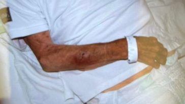 Mărturii cutremurătoare despre pacienţii exploataţi de reţeaua din Bihor – Pacient cu traumatism cranian vechi de trei zile, fără asistenţă medicală. Medicul şef UPU SMURD Bihor: Pe unii îi abandonau în gara din Oradea sau în UPU ca să scape de ei