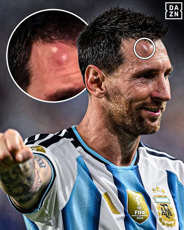 Cupa Mondială 2026: Messi ştia că „urma să fie un meci foarte greu” împotriva Capului Verde / Starul argentinian, aşteptat de jucătorii adverşi pentru poze – VIDEO