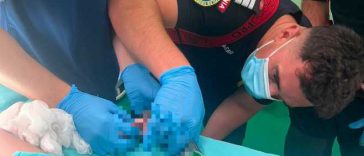 Mureș: Intervenție dificilă pentru salvarea unui copil de 2 ani cu mâna prinsă într-o mașină de tocat