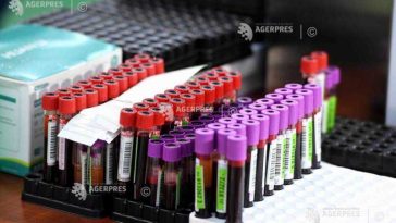 Alba: Focar de hepatită de tip A; au fost confirmate șapte cazuri, la copii