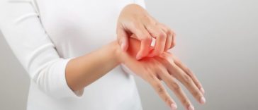 14 septembrie – Ziua mondială a Dermatitei Atopice