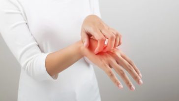 14 septembrie – Ziua mondială a Dermatitei Atopice