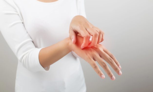 14 septembrie – Ziua mondială a Dermatitei Atopice