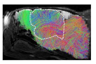 Oamenii de știință au obținut ‘organoizi’ din celule cerebrale umane crescute pe șoareci