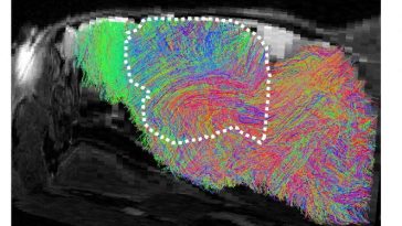 Oamenii de știință au obținut ‘organoizi’ din celule cerebrale umane crescute pe șoareci