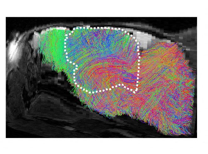 Oamenii de știință au obținut ‘organoizi’ din celule cerebrale umane crescute pe șoareci