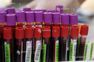 O genă care ajută bacteriile intestinale dăunătoare să reziste la antibiotice și dezinfectanți, descoperită de cercetători australieni