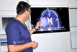 Președintele Societății Române de Neurochirurgie: Nu există nimic suplimentar în țările vestice față de ce avem noi în domeniu
