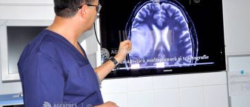 Președintele Societății Române de Neurochirurgie: Nu există nimic suplimentar în țările vestice față de ce avem noi în domeniu