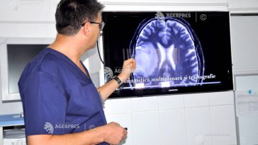 Președintele Societății Române de Neurochirurgie: Nu există nimic suplimentar în țările vestice față de ce avem noi în domeniu